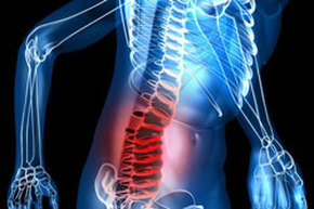 back pain graphic